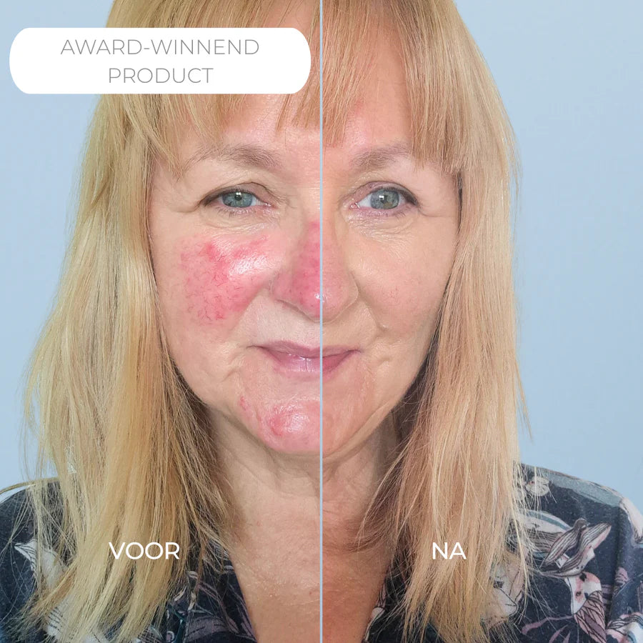 Anti-redness skincare