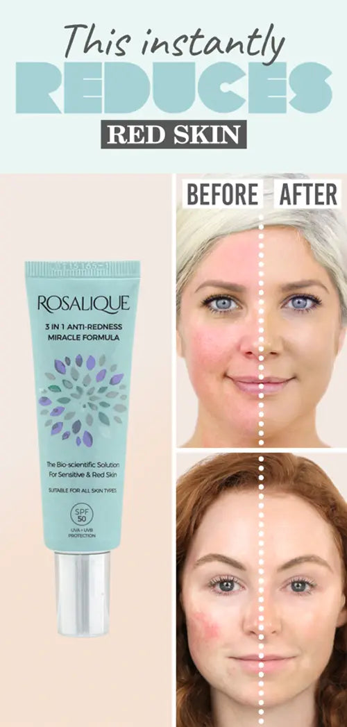 Anti-redness skincare